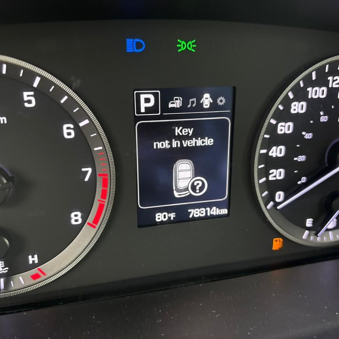 Sunroof & Thumbstart: 2015 Sonata Sport!